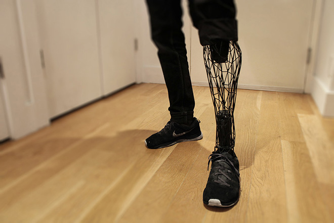 Exo Prosthetic Leg – La protesi del futuro