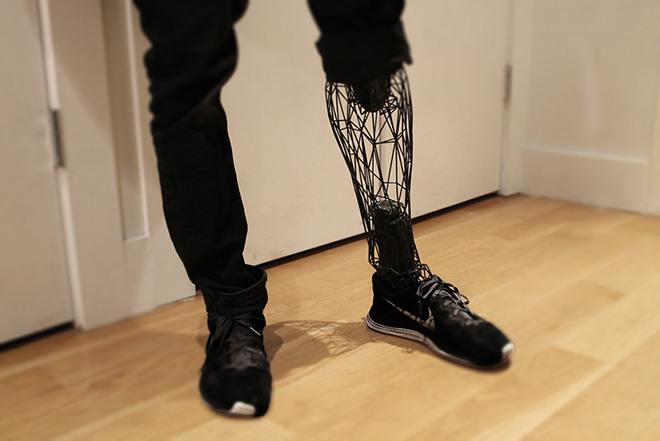 Exo Prosthetic Leg - La protesi del futuro