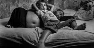 Constanza Portnoy - Life force, best project social photography, Perugia Social Photo Fest - The skin I live