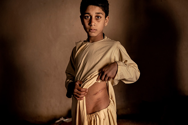 Title: The Price of Peace in Afghanistan. © Mads Nissen, Politiken/Panos Pictures. World Press Photo Stories of the Year