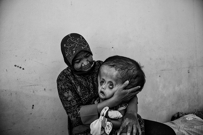 Erberto Zani (Switzerland) - Mercury poisoning in Indonesia, Merit Gallery, All About Photo - AAP Magazine #31: PORTRAIT