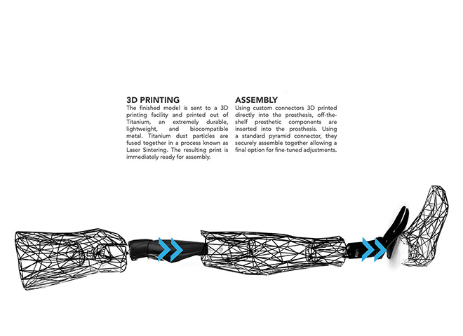 Exo Prosthetic Leg - La protesi del futuro