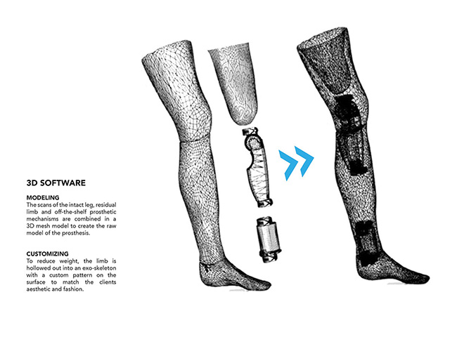 Exo Prosthetic Leg - La protesi del futuro