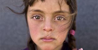 Muhammed Muheisen / AP Photo - Zahra Mahmoud, 5 anni. Proviene da Deir el-Zour, Siria. La foto è stata scattata l'11 marzo in un campo profughi vicino al confine siriano nella periferia di Mafraq, Giordania.