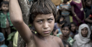 ©K M Asad - Battle victim. Location: Ukhiya (Bangladesh). SIPAContest Photo of the Year. Siena International Photo Awards 2018.